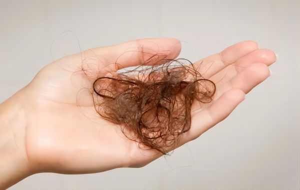 How Much Hair Loss Is Normal?Fun Facts To Know