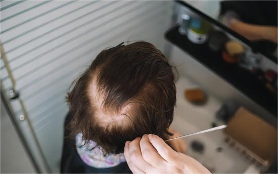 How To Make Thin Hair Look Thicker