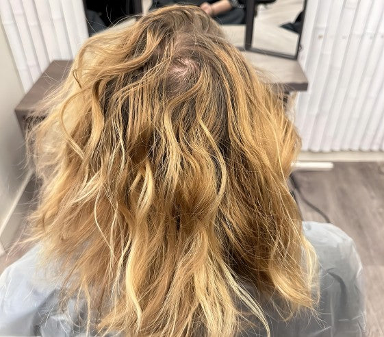 My hair is so thin I can see my scalp!Why & What to do?